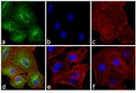 Rat IgG (H+L) Highly Cross-Adsorbed Secondary Antibody in Immunocytochemistry (ICC/IF)