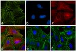 Rat IgG (H+L) Cross-Adsorbed Secondary Antibody in Immunocytochemistry (ICC/IF)