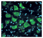 HuC/HuD Antibody in Immunohistochemistry (IHC)