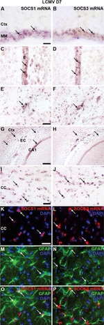 GFAP Antibody in Immunohistochemistry (IHC)