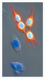 GFP Antibody in Immunocytochemistry (ICC/IF)