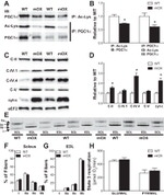 ATP Synthase beta Antibody in Western Blot (WB)