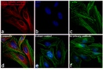 Rabbit IgG (H+L) Cross-Adsorbed Secondary Antibody in Immunocytochemistry (ICC/IF)