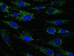 ECH1 Antibody in Immunocytochemistry (ICC/IF)