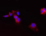 CPT2 Antibody in Immunocytochemistry (ICC/IF)