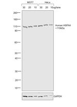 Human IgG Fc Cross-Adsorbed Secondary Antibody in Western Blot (WB)