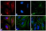 Mouse IgG (H+L) Highly Cross-Adsorbed Secondary Antibody in Immunocytochemistry (ICC/IF)