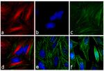 Mouse IgG (H+L) Secondary Antibody in Immunocytochemistry (ICC/IF)