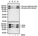 Mouse IgG (H+L) Secondary Antibody in Western Blot (WB)