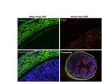 Mouse IgG (H+L) Secondary Antibody in Immunohistochemistry (Paraffin) (IHC (P))