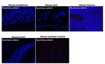 Mouse IgG (H+L) Secondary Antibody in Immunohistochemistry (Paraffin) (IHC (P))