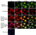 Mouse IgG (H+L) Secondary Antibody in Immunocytochemistry (ICC/IF)