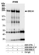 BRCA1 Antibody in Immunoprecipitation (IP)