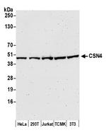 CSN4 Antibody in Western Blot (WB)