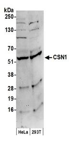 CSN1 Antibody in Western Blot (WB)