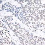 USP7 Antibody in Immunohistochemistry (Paraffin) (IHC (P))