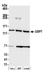 USP7 Antibody in Western Blot (WB)