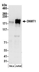 DNMT1 Antibody in Western Blot (WB)