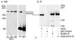 ROCK2 Antibody in Western Blot (WB)