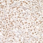 Phospho-SMC1 (Ser966) Antibody in Immunohistochemistry (Paraffin) (IHC (P))