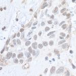 Phospho-SMC1 (Ser966) Antibody in Immunohistochemistry (Paraffin) (IHC (P))