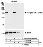 Phospho-SMC1 (Ser966) Antibody in Immunoprecipitation (IP)