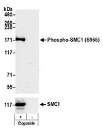 Phospho-SMC1 (Ser966) Antibody in Western Blot (WB)