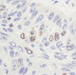 Topo II Alpha Antibody in Immunohistochemistry (Paraffin) (IHC (P))