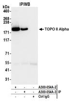 Topo II Alpha Antibody in Immunoprecipitation (IP)