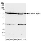 Topo II Alpha Antibody in Western Blot (WB)