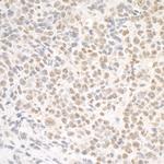 SMC1 Antibody in Immunohistochemistry (Paraffin) (IHC (P))