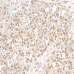 SMC1 Antibody in Immunohistochemistry (Paraffin) (IHC (P))