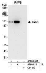 SMC1 Antibody in Immunoprecipitation (IP)