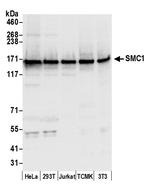 SMC1 Antibody in Western Blot (WB)