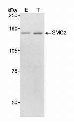 SMC2 Antibody in Western Blot (WB)