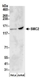 SMC2 Antibody in Western Blot (WB)