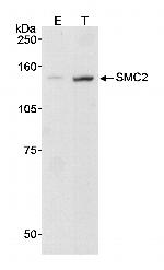 SMC2 Antibody in Western Blot (WB)