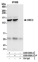 SMC2 Antibody in Western Blot (WB)