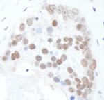 Phospho-XRCC1 (Ser518,Thr519,Thr523) Antibody in Immunohistochemistry (Paraffin) (IHC (P))