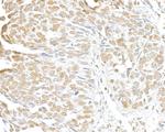 SMC3 Antibody in Immunohistochemistry (Paraffin) (IHC (P))