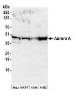 Aurora A Antibody in Western Blot (WB)