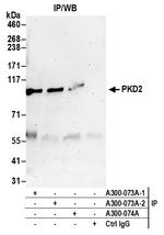 PKD2 Antibody in Immunoprecipitation (IP)