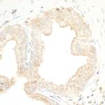 PKD2 Antibody in Immunohistochemistry (Paraffin) (IHC (P))