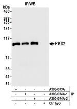 PKD2 Antibody in Immunoprecipitation (IP)