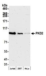 PKD2 Antibody in Western Blot (WB)