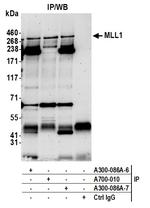 MLL1 Antibody in Immunoprecipitation (IP)