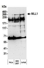 MLL1 Antibody in Western Blot (WB)