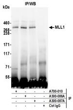 MLL1 Antibody in Immunoprecipitation (IP)