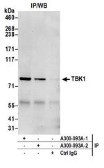 TBK1 Antibody in Immunoprecipitation (IP)