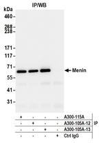 Menin Antibody in Immunoprecipitation (IP)